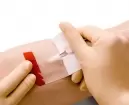Curativo Essity Leukomed IV Filme para Fixação de Cateter